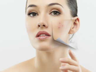 How Easily To Get Rid Of Acne Scars Naturally