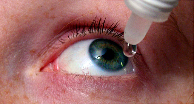 Dry Eyes problem - Symptoms, Causes, prevention and Treatment