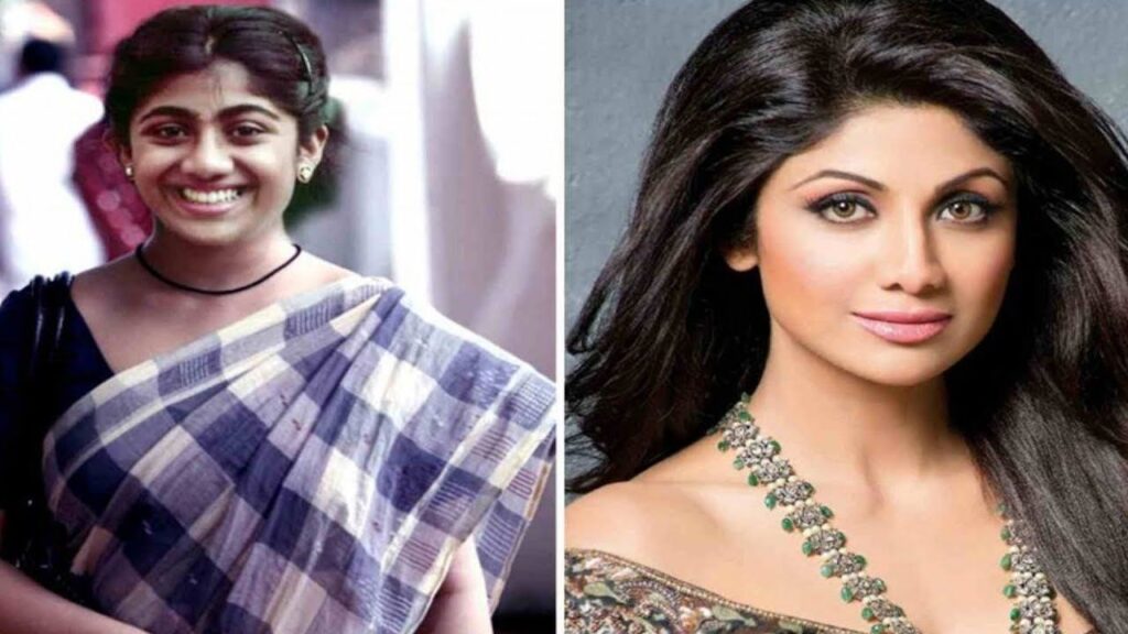Bollywood Celebrity Plastic Surgery Before and After