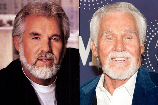 Kenny-Rogers-plastic-surgery-before-and-afterjpg