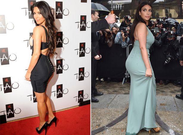 Kim-Kardashian-butt-implant