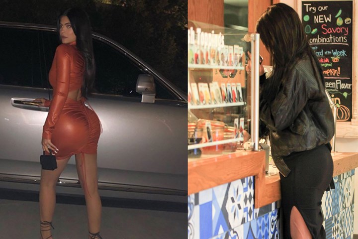 Kylie Jenner Butts Job.