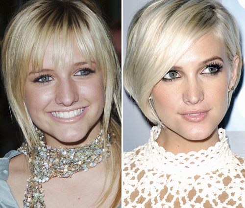 ashlee-simpson-before-after-plastic-surgery