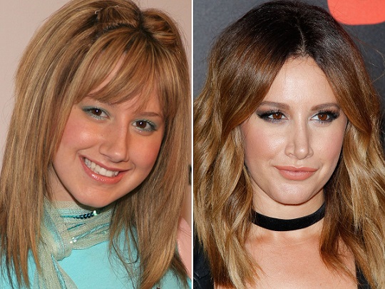 ashley-tisdale-before-and-after-plastic-surgery