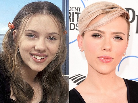 scarlett-johansson-plastic-surgecy-before-and-after