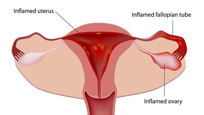 Causes For Menstrual Cramps