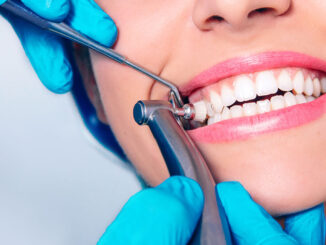 What you need to know about dental hygiene with braces