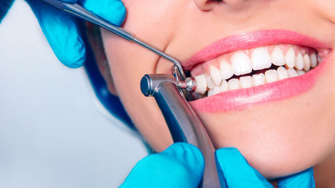 What you need to know about dental hygiene with braces