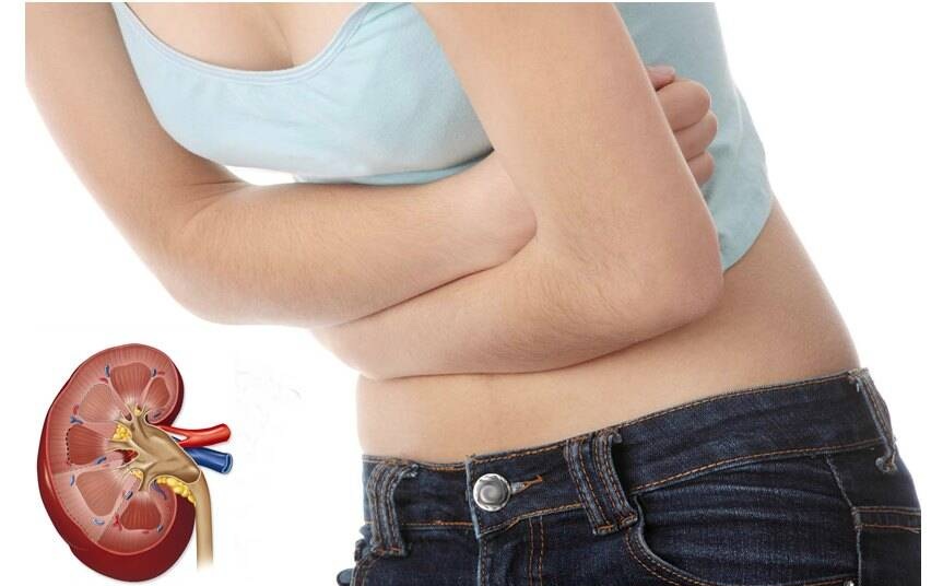 Avurvedic, Non-Surgical Kidney Stone Removal