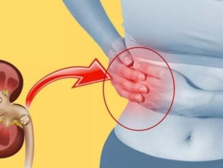 Remove Kidney Stones Without Surgery