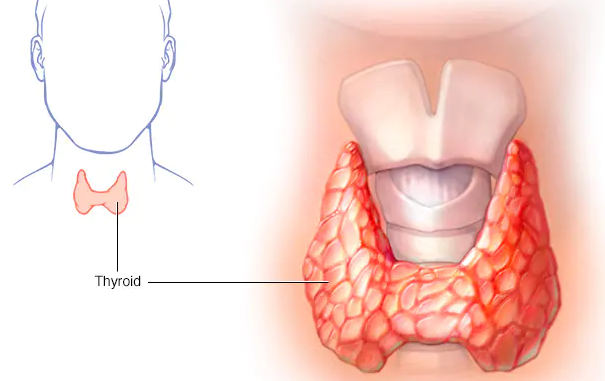 Uncontrolled Thyroid: Exercise and Diet Risks