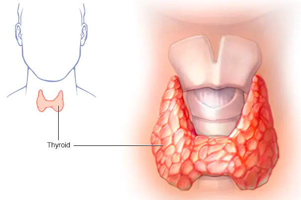 Uncontrolled Thyroid: Exercise and Diet Risks