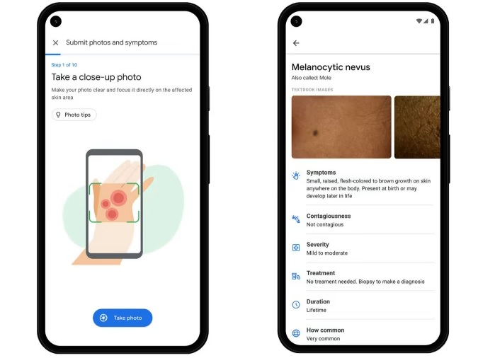 Google has unveiled an AI-powered skin problem diagnostic tool.