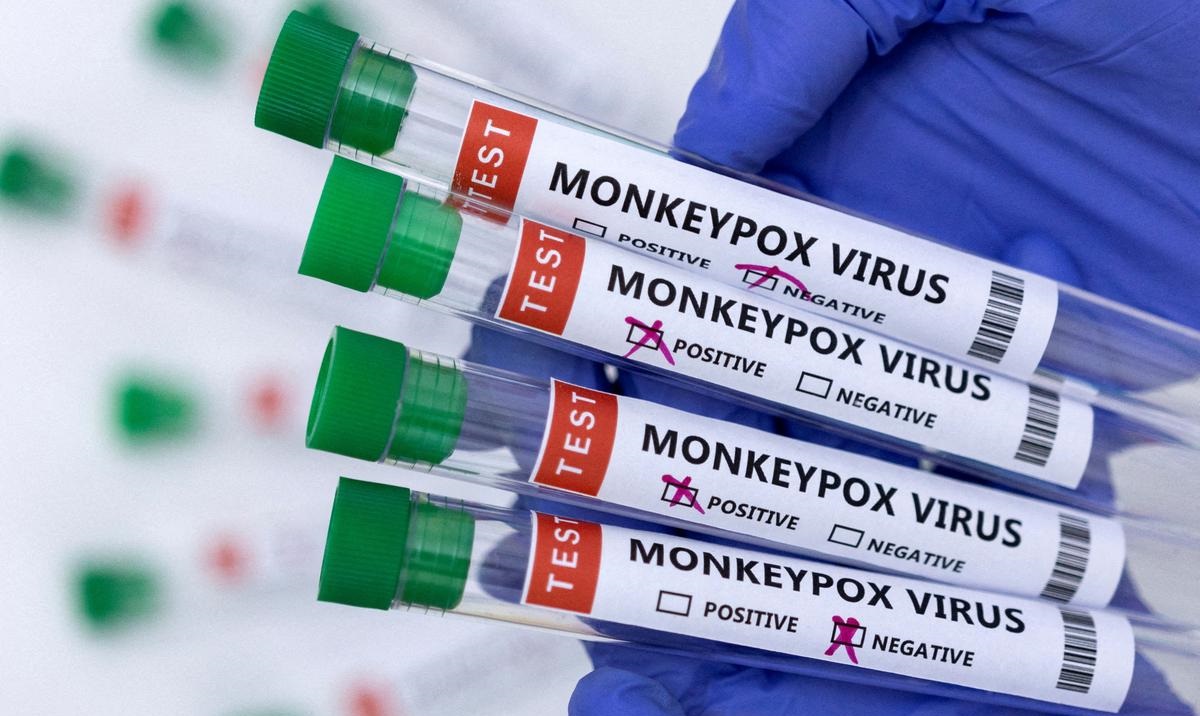 monkeypox virus