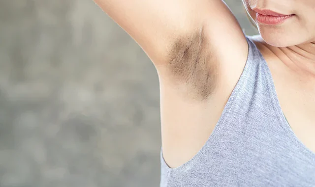 Remedies to Brighten up Your Dark Underarms