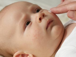 Advice for parents dealing with a baby who has a rash
